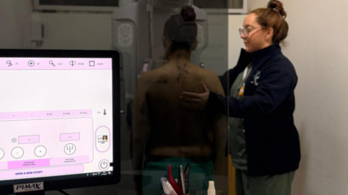 Más de 2.400 mamografías realizadas en el Hospital de Monte